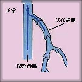 下肢の静脈